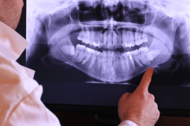 Best Emergency Dentist for Knocked-Out Tooth in Clarksville, IA